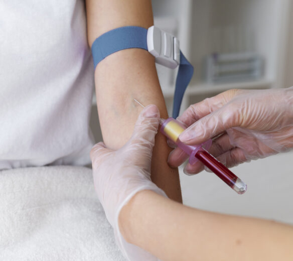 bloedafname bij jong persoon