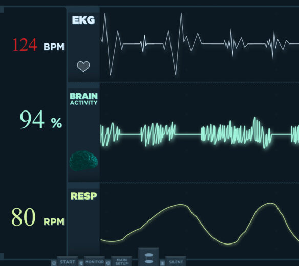 ECG op scherm